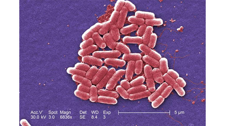 University Researchers Develop Rapid Nanosensor for E. coli